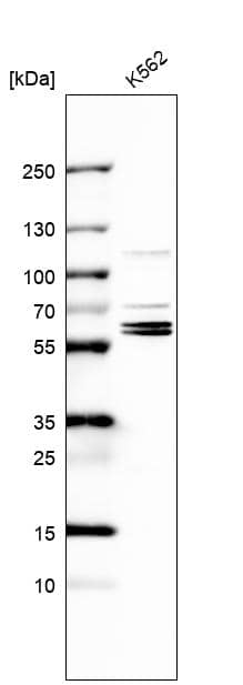 Western Blot TROVE2 Antibody - BSA Free