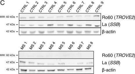 Ro60 and La proteins are depressed in RRMS. (A) Ro60 (TROVE2) and La (SSB) transcript levels in CTRL (N = 24), CIS-MS (N = 16), RRMS (N = 22), RA (N = 18), SLE (N = 24), NMO (N = 22), and PD (N = 19) were determined by quantitative PCR after cDNA synthesis using oligo-dT. Results are normalized to CTRL = 1.0 after normalization to transcript levels of GAPDH, error bars are S.D. (B) As in (A) using whole genome RNA-sequencing data. (C) Western blotting to determine Ro60 and La protein levels in PBMC from CTRL (N = 9) and RRMS (N = 8). (D) Quantitative estimates of protein abundance relative to  beta -actin. *P <0.05, **P <0.01. Image collected and cropped by CiteAb from the following open publication (//pubmed.ncbi.nlm.nih.gov/25885816), licensed under a CC-BY license. Not internally tested by Novus Biologicals.