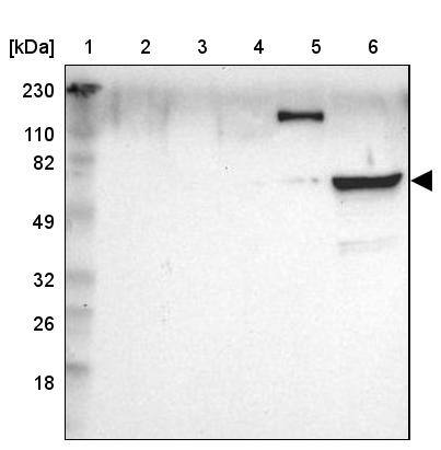 Lane 1: Marker [kDa] 230, 110, 82, 49, 32, 26, 18Lane 2: Human cell line RT-4Lane 3: Human cell line U-251MG spLane 4: Human plasma (IgG/HSA depleted)Lane 5: Human liver tissueLane 6: Human tonsil tissue