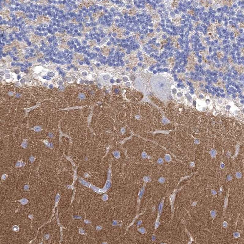 Staining of human cerebellum shows strong cytoplasmic positivity in cells in molecular layer.