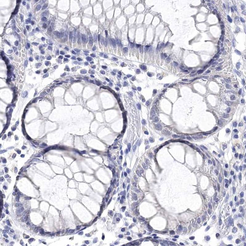 Staining of human rectum shows no positivity in glandular cells as expected.