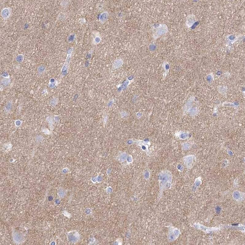 Staining of human cerebral cortex shows moderate cytoplasmic positivity in neuropil.