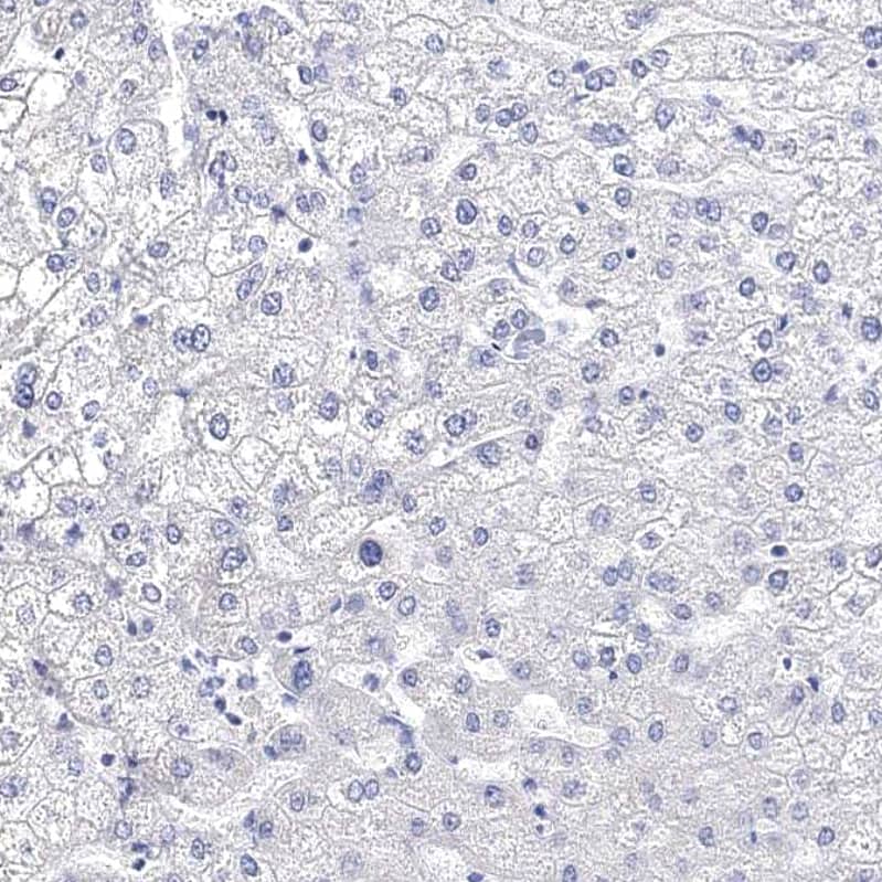 Staining of human liver shows very weak cytoplasmic positivity in hepatocytes.
