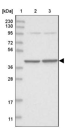 Lane 1: Marker [kDa] 230, 130, 95, 72, 56, 36, 28, 17, 11Lane 2: Human cell line RT-4Lane 3: Human cell line U-251MG sp