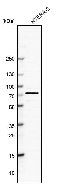 Analysis in human cell line NTERA-2.