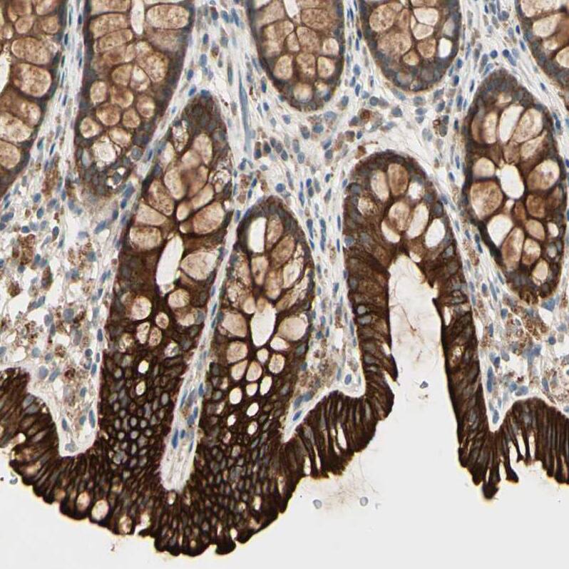 Staining of human colon shows strong cytoplasmic positivity in glandular cells.