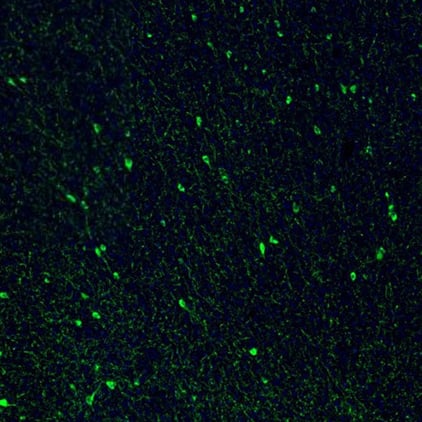 Staining of mouse brain shows strong positivity in a subset of neurons in the cerebral cortex.