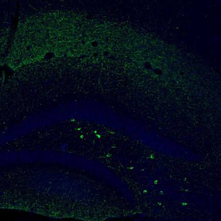 Staining of mouse dentate gyrus shows moderate to strong positivity in a subset of neurons in the polymorph layer.