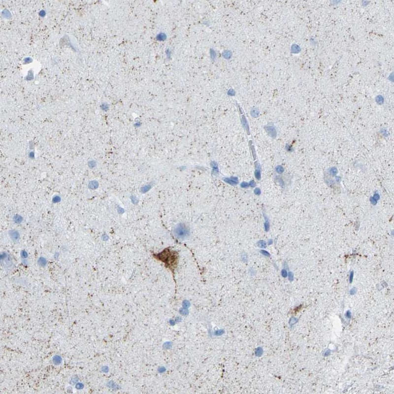 Staining of human cerebral cortex shows moderate cytoplasmic positivity in neurons, as well as immunoreactivity in neural processes.