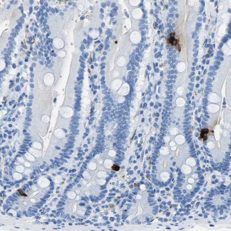 Staining of human duodenum shows strong cytoplasmic positivity in neuroendocrine cells.