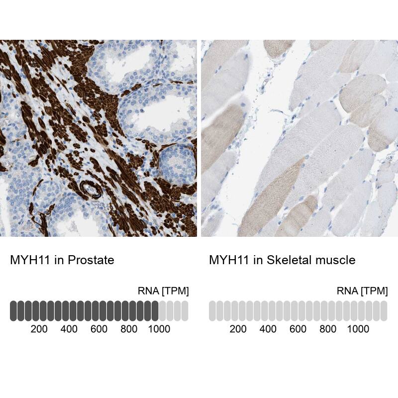 <b>Orthogonal Strategies Validation. </b>Analysis in human prostate and skeletal muscle tissues Corresponding MYH11 RNA-seq data are presented for the same tissues.