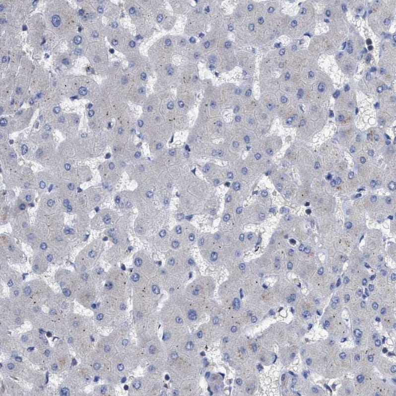 Immunohistochemistry-Paraffin RAP1GDS1 Antibody - BSA Free