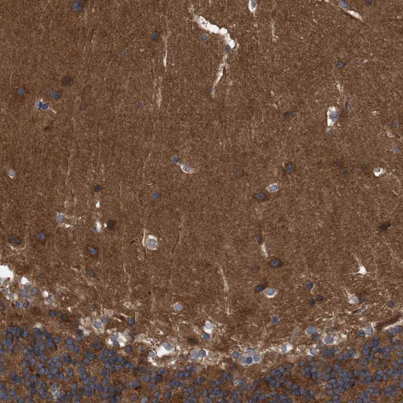Immunohistochemistry-Paraffin RAP1GDS1 Antibody - BSA Free