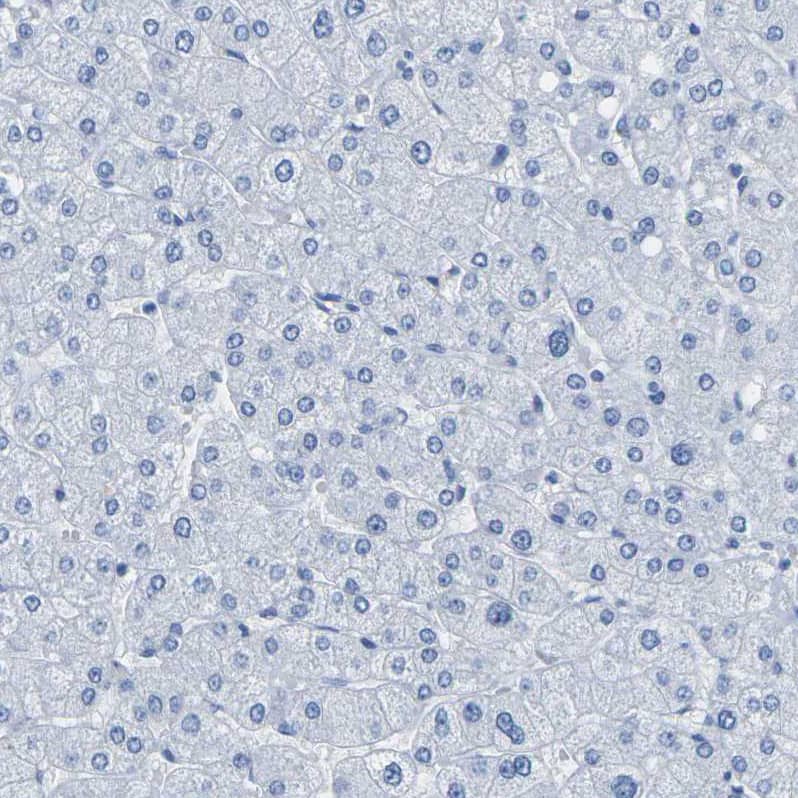 Immunohistochemistry-Paraffin Calponin 1 Antibody - BSA Free