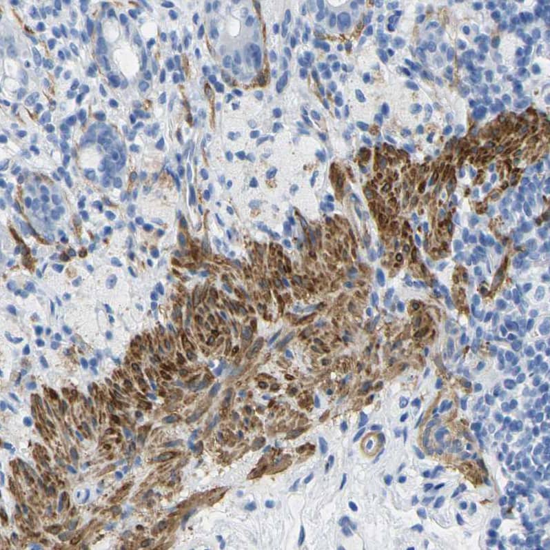 Immunohistochemistry-Paraffin Calponin 1 Antibody - BSA Free
