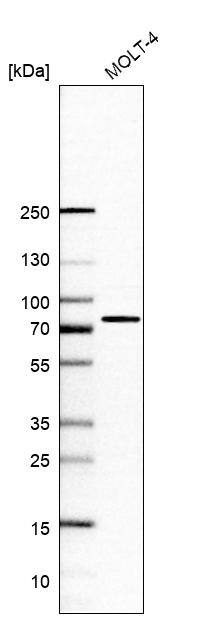 Analysis in human cell line MOLT-4.