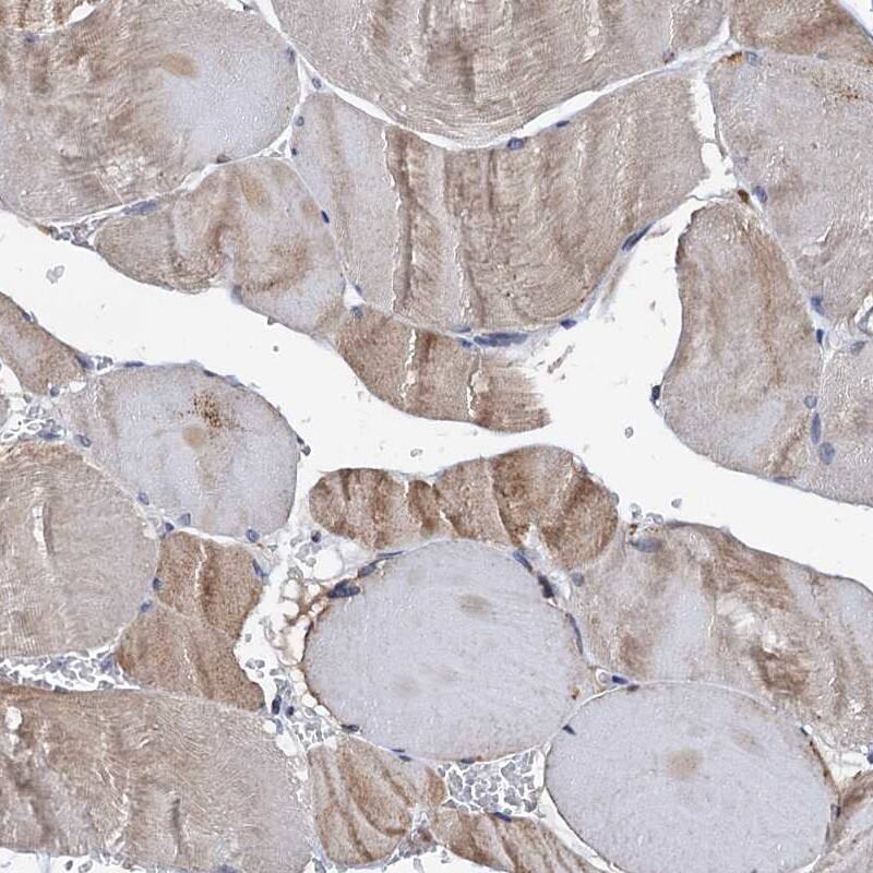 Staining of human skeletal muscle shows low expression as expected.