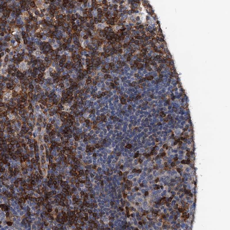 Staining of human lymph node shows high expression.