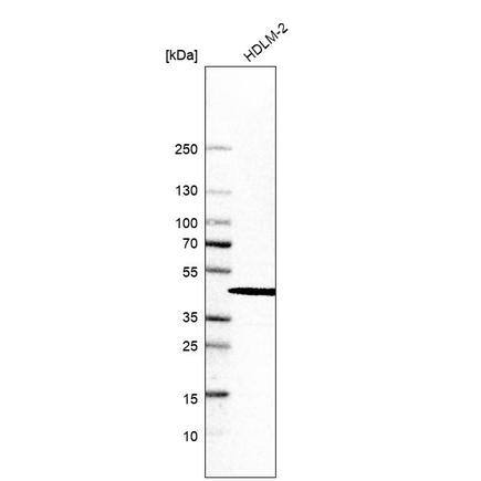 Analysis in human cell line HDLM-2.