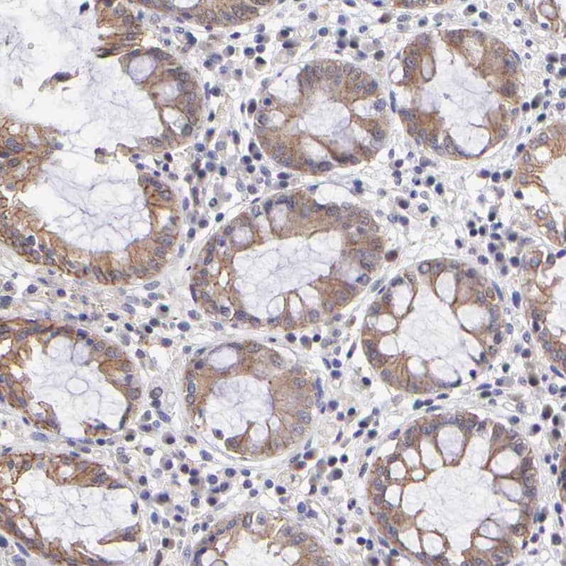 Staining of human rectum shows moderate cytoplasmic positivity in glandular cells.