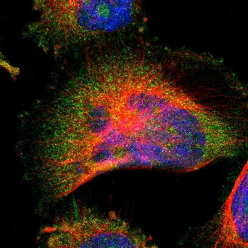 Staining of human cell line U-251 MG shows localization to nucleoli, plasma membrane & cytosol.