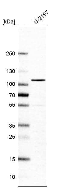 Analysis in human cell line U-2197.