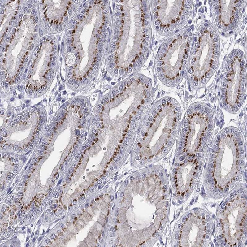 Immunohistochemistry-Paraffin ST6GALNAC1 Antibody - BSA Free