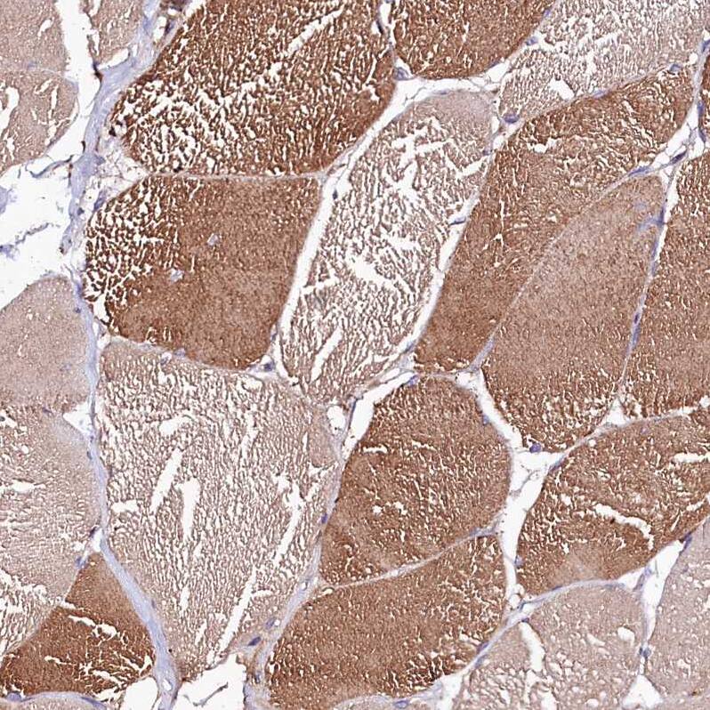 Staining of human skeletal muscle shows moderate cytoplasmic positivity in myocytes.