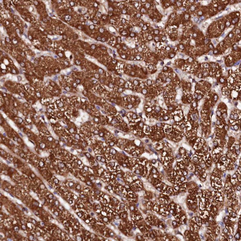 Staining of human liver shows strong cytoplasmic positivity in hepatocytes.