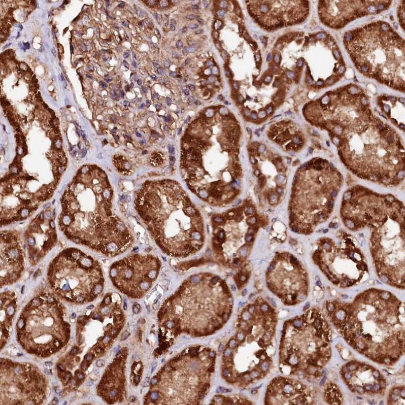 Staining of human kidney shows strong cytoplasmic positivity in cells in tubules.