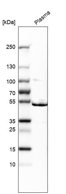 Analysis in human plasma.