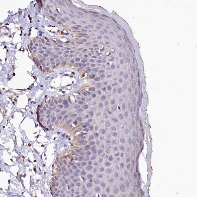 Staining of human skin shows very weak cytoplasmic positivity in squamous epithelial cells as expected.