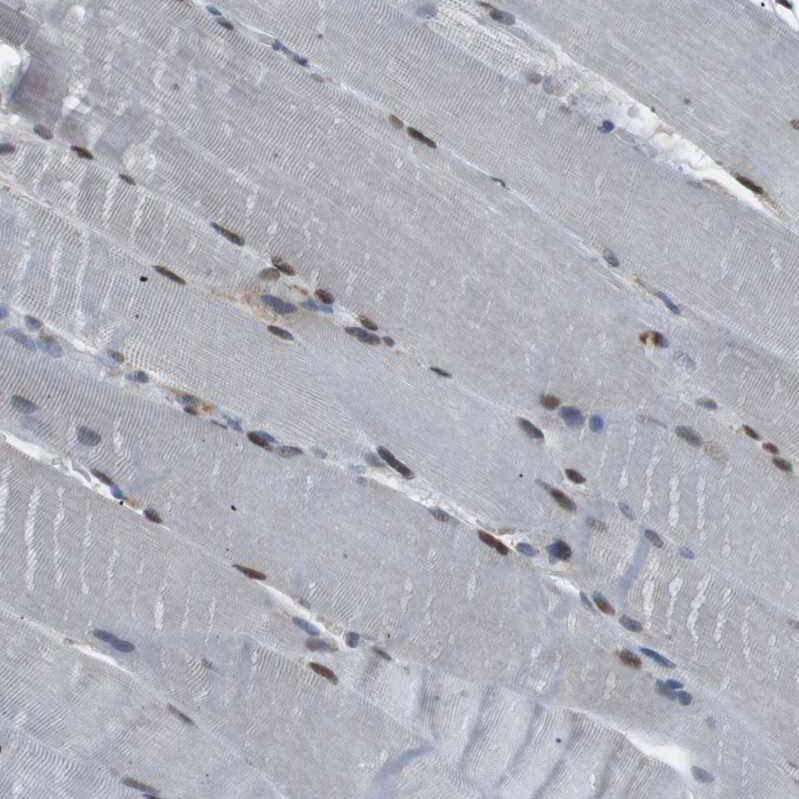 Immunohistochemistry-Paraffin SRPK2 Antibody - BSA Free