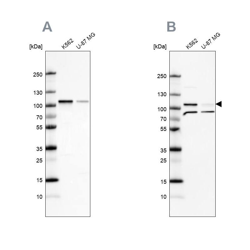 <b>Independent Antibodies Validation. </b>Analysis using Anti-SRPK1 antibody NBP1-87050 (A) shows similar pattern to independent antibody NBP2-58538 (B).