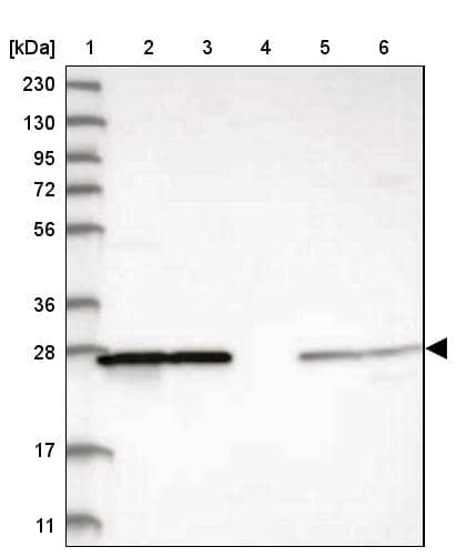 Western Blot PMM1/Phosphomannomutase 1 Antibody - BSA Free