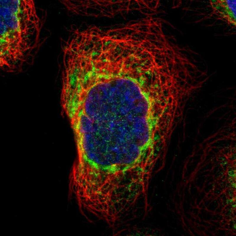 Staining of human cell line A-431 shows localization to endoplasmic reticulum.