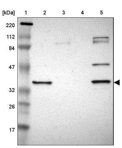 Lane 1: Marker [kDa] 220, 112, 84, 47, 32, 26, 17Lane 2: Human cell line RT-4Lane 3: Human cell line U-251MG spLane 4: Human plasma (IgG/HSA depleted)Lane 5: Human liver tissue