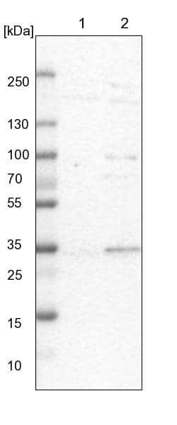 Lane 1: NIH-3T3 cell lysate (Mouse embryonic fibroblast cells)Lane 2: NBT-II cell lysate (Rat Wistar bladder tumour cells)
