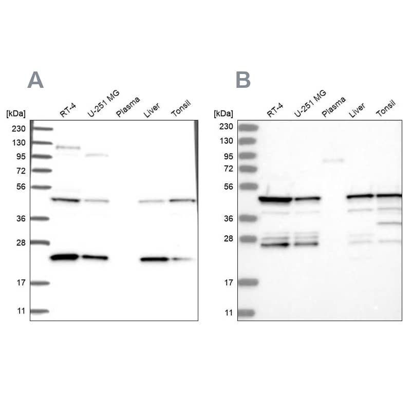 Analysis using NBP1-87059 (A) shows similar pattern to independent antibody NBP2-38207 (B).