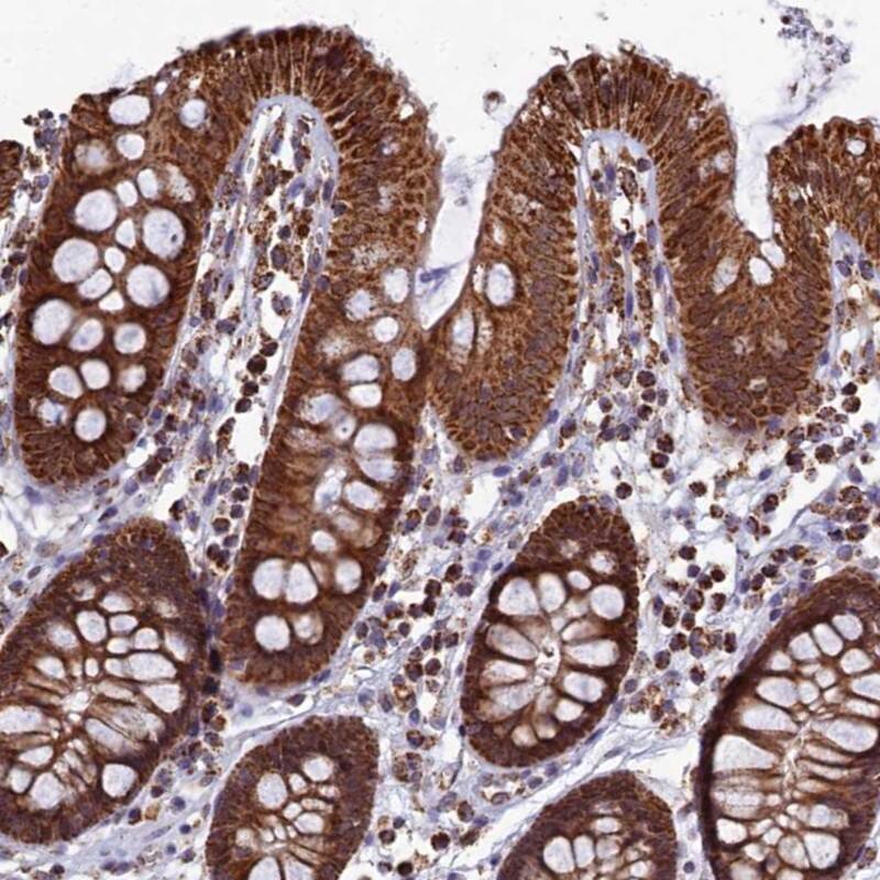 Staining of human colon shows strong cytoplasmic positivity in glandular cells.