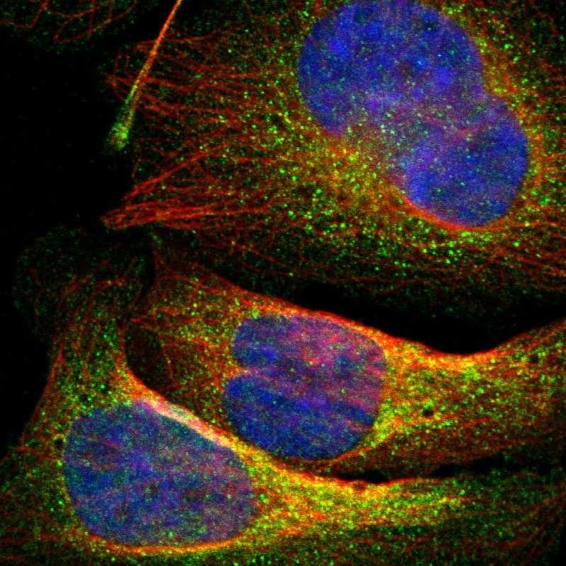 Staining of human cell line U-2 OS shows localization to cytosol.