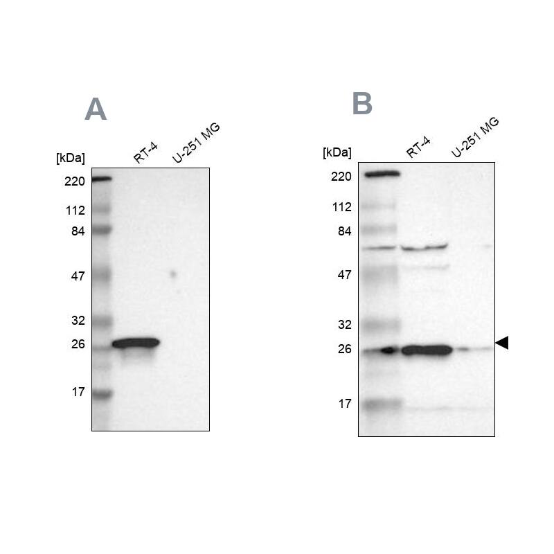 <b>Independent Antibodies Validation. </b>Analysis using Anti-HPGD antibody NBP1-87061 (A) shows similar pattern to independent antibody NBP1-87062 (B).
