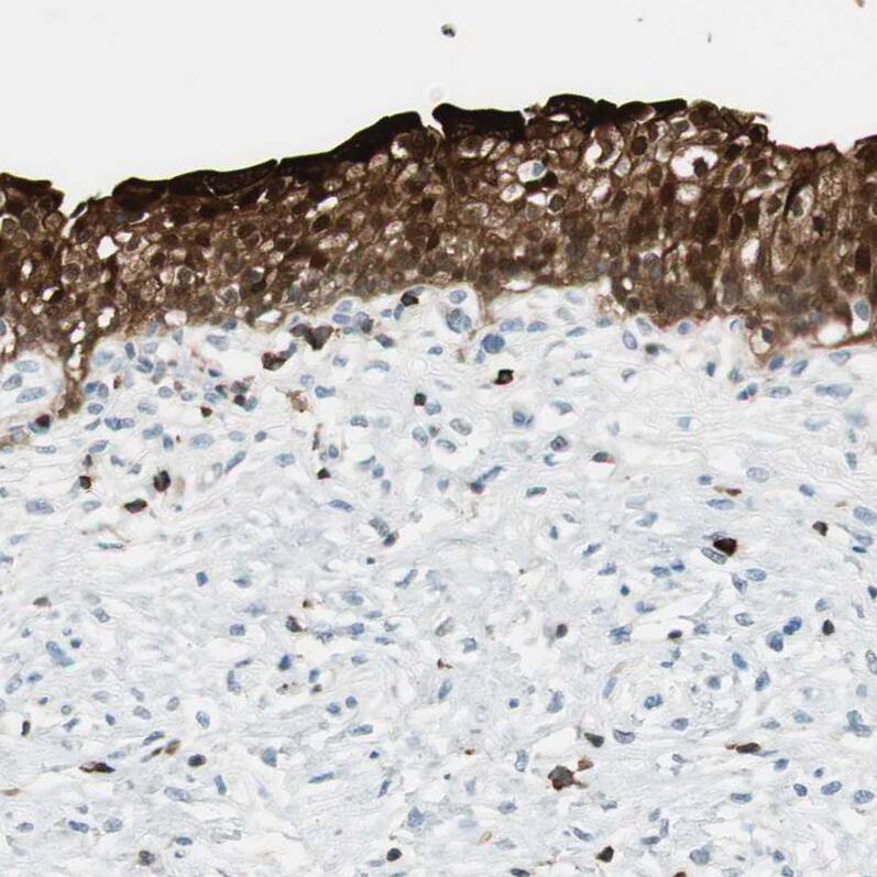 Staining of human urinary bladder shows strong cytoplasmic positivity in urothelial cells.