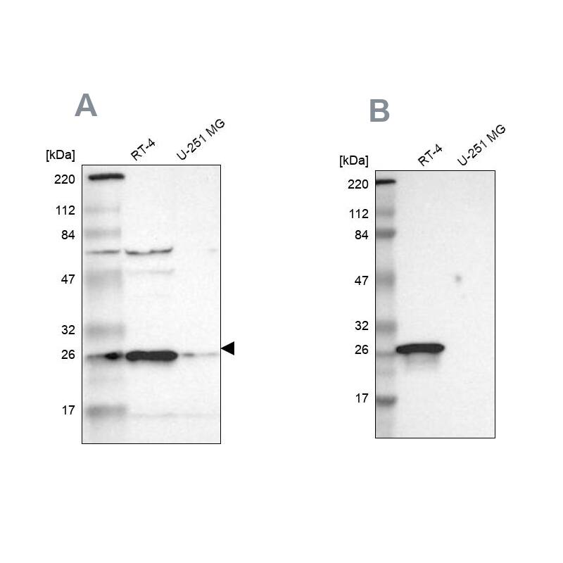 <b>Independent Antibodies Validation. </b>Analysis using Anti-HPGD antibody NBP1-87062 (A) shows similar pattern to independent antibody NBP1-87061 (B).