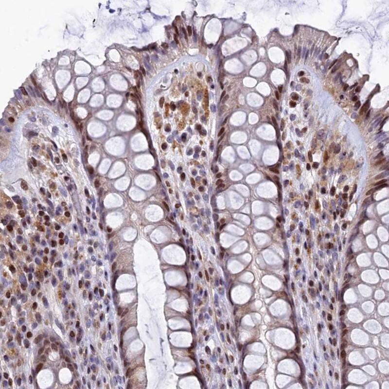 Staining of human rectum shows moderate nuclear positivity in glandular cells.