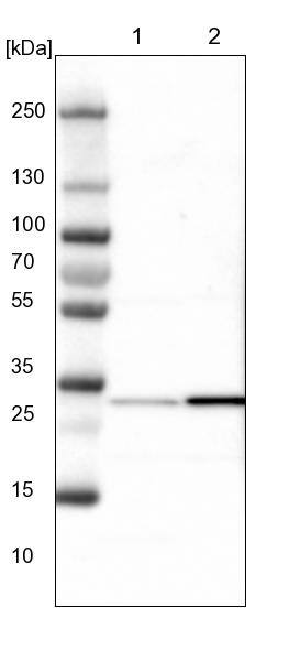 Lane 1: NIH-3T3 cell lysate (Mouse embryonic fibroblast cells)Lane 2: NBT-II cell lysate (Rat Wistar bladder tumour cells)
