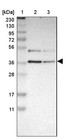 Lane 1: Marker [kDa] 230, 130, 95, 72, 56, 36, 28, 17, 11Lane 2: Human cell line RT-4Lane 3: Human cell line U-251MG sp