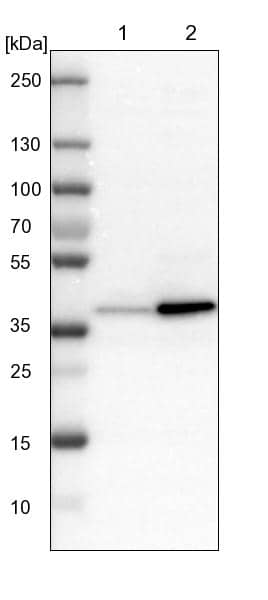 Lane 1: NIH-3T3 cell lysate (Mouse embryonic fibroblast cells)Lane 2: NBT-II cell lysate (Rat Wistar bladder tumour cells)