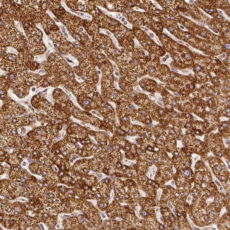 Staining of human liver shows moderate to strong granular cytoplasmic positivity in hepatocytes.