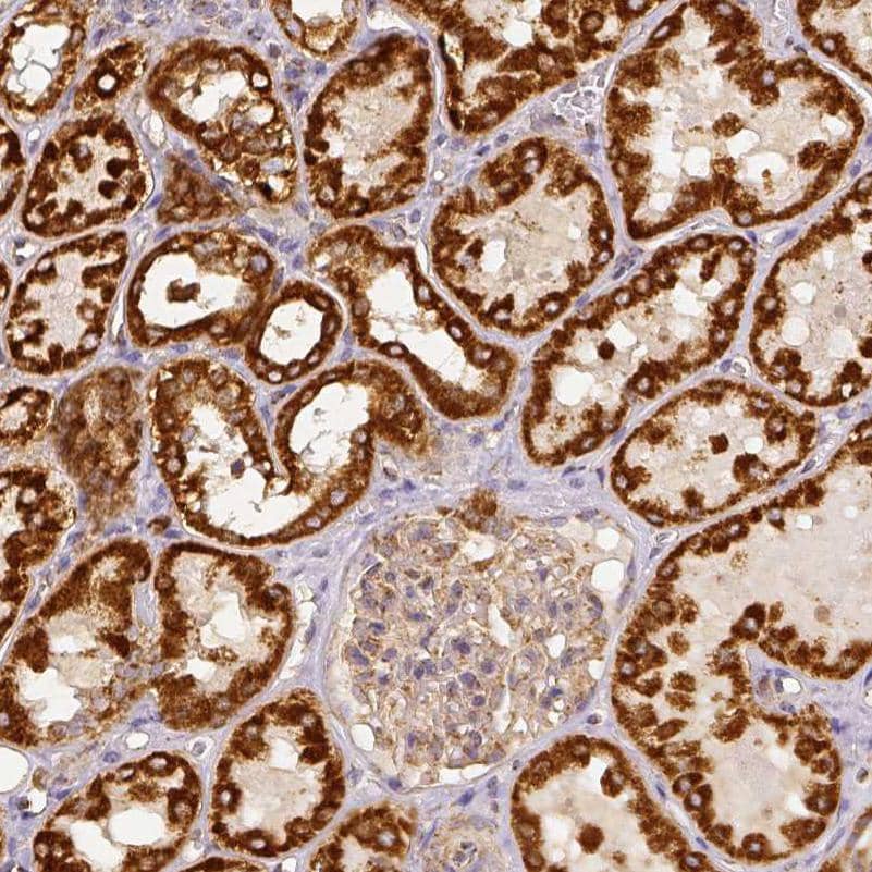 Staining of human kidney shows moderate to strong granular cytoplasmic positivity in cells in tubules.